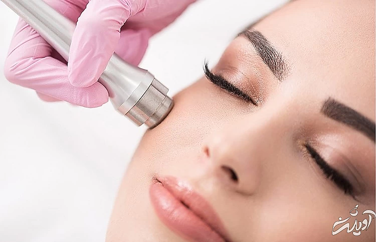 همه چیز درباره جوانسازی و زیبایی پوست با میکرودرم